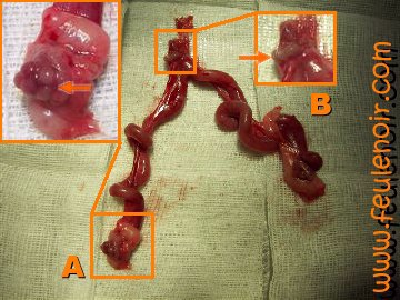 photo d'un utérus de furette présentant un pyomètre. L'utérus ressemble à un Y.